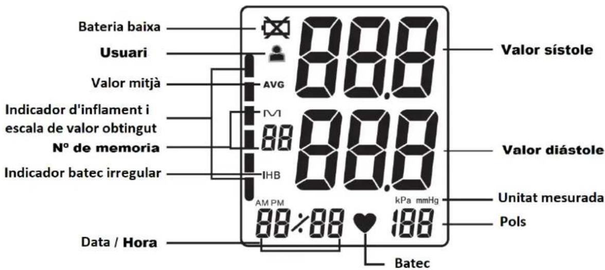 Orbegozo TES 3650 - Pantalla - 1