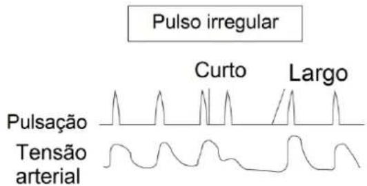 Orbegozo TES 3650 - DETEÇÃO DE PULSO IRREGULAR - 2