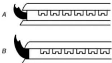 AMANA AGC6540KFS - Système d'allumage électronique - 2