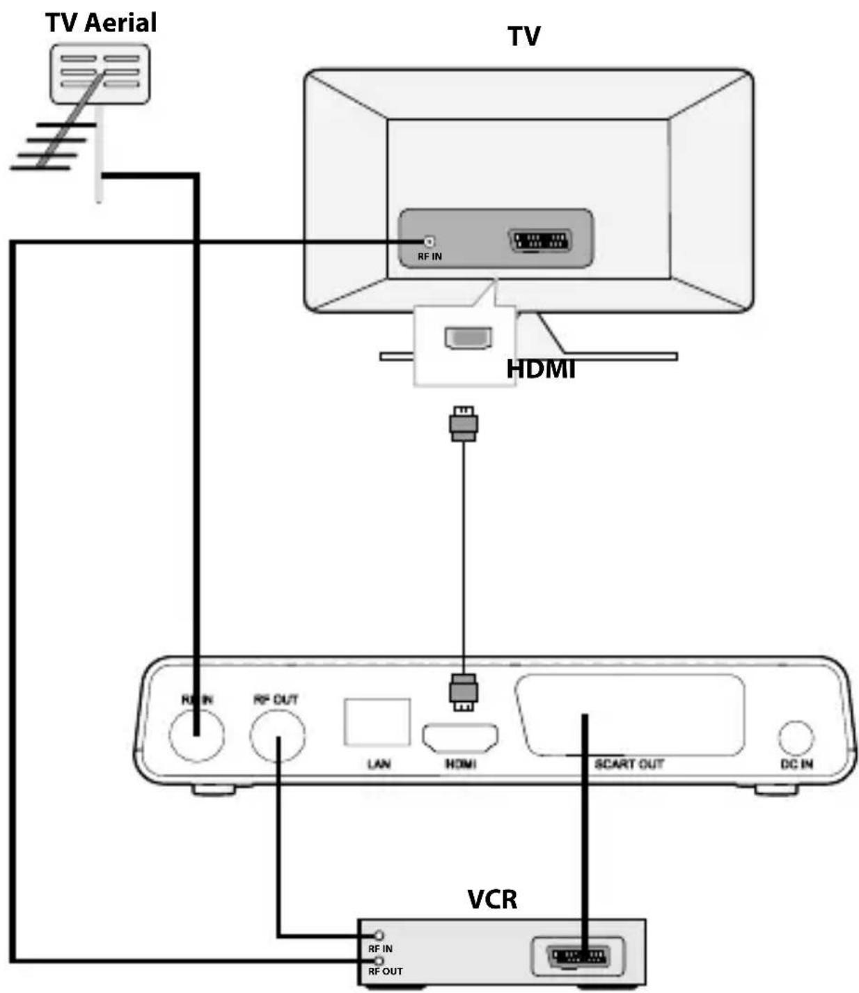 NEDIS DVBT2265BK - 3