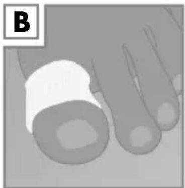 Sensiplast IAN 107816 - Application de l'article - 2
