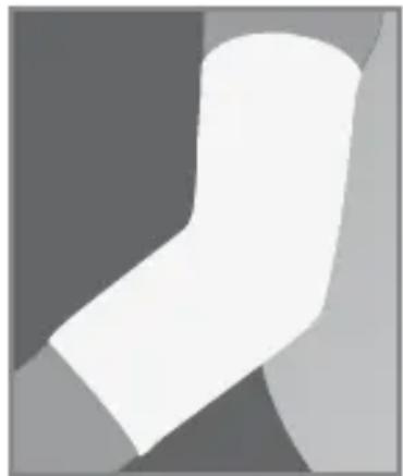 Sensiplast IAN 64581 - Applying the Bandage - 1