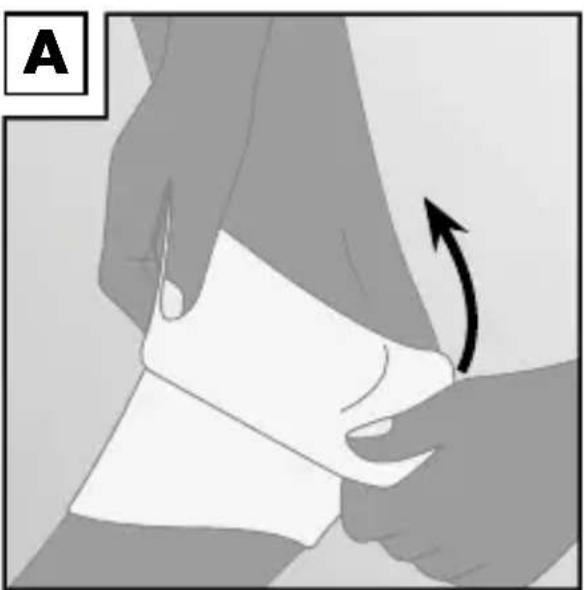 Sensiplast IAN 274662 - Applying the brace - 1
