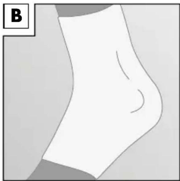Sensiplast IAN 274662 - DE AT CH - 3