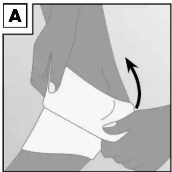 Sensiplast IAN 274662 - Applicazione della fasciatura - 1