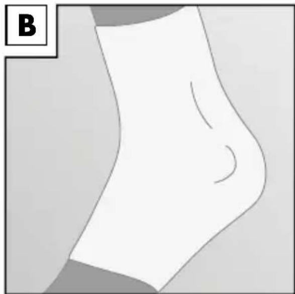 Sensiplast IAN 274662 - DE AT CH - 2