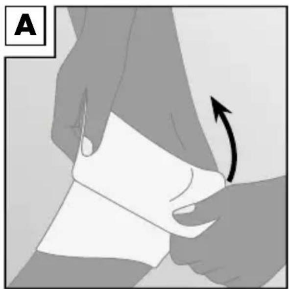 Sensiplast IAN 274662 - Pose du bandage - 1