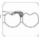 Concept Perfect Smile ZK4011 - Modulile de curatare - 4