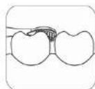 Concept Perfect Smile ZK4011 - Tisztfasi modok - 4