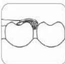 Concept Perfect Smile ZK4011 - Reinlgungsmod - 4