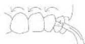 Concept Perfect Smile ZK4021 - Einsatz - 4