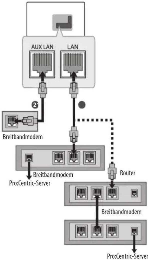 LG 65UW961H - Kabelgebundene Netzwerkverbindung - 1