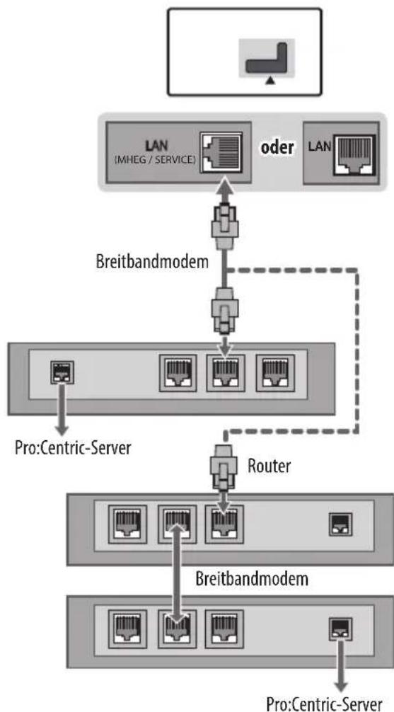 LG 32LW300C - Kabelgebundene Netzwerkverbindung - 1