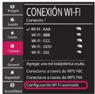 LG 86SM9000PLA - CONFIGURACION DE RED - 5