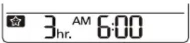 LG UM24FH - Einstellen des Sleep-Timers - 1