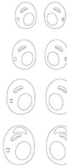 soundcore Liberty 3 Pro - (Ear Wings) on w - 1