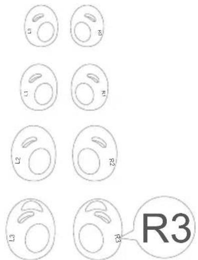 soundcore Liberty 3 Pro - BytaÖronvingar - 1