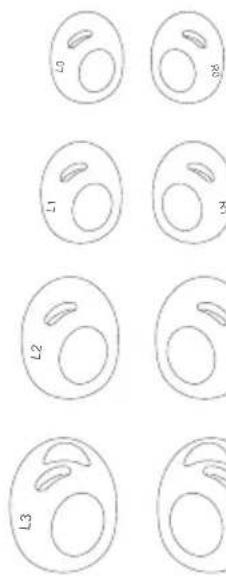 soundcore Liberty 3 Pro - Wymiana nasadek Ear Wings - 1