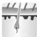 Concept Perfect Skin IL3020 - INFLUENCE OF HAIR GROWTH CYCLE ON PHOTOEPILATION - 1