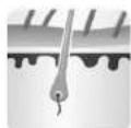 Concept Perfect Skin IL3020 - ZASTOSOWANIE - 4