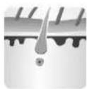 Concept Perfect Skin IL3020 - INFLUENCE OF HAIR GROWTH CYCLE ON PHOTOEPILATION - 2