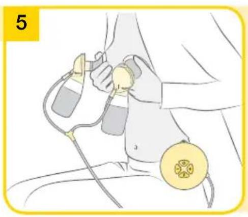 MEDELA Swing Maxi Flex - Swing Maxi Flex - Menyiapkan pemopmaan ganda - 6