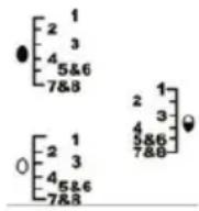 ECG UV 5080 - Munadevalmistamine - 1