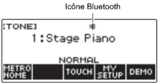 CASIO CTS400 - IMPORTANT! - 1