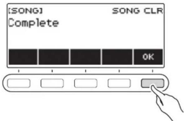 CASIO LKS450 - Quand « Complete » apparaît sur l'affichage, appuyez sur OK. - 1