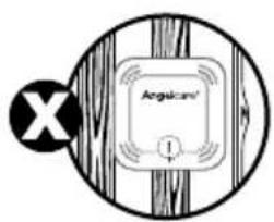 ANGELCARE AC320 - 2- SETTING UP THE SENSOR PAD - 3