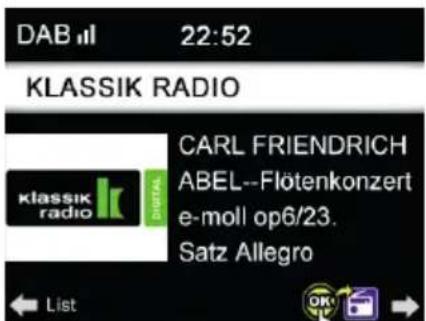 ALBRECHT DR 884 - DAB/FM Setup - 1
