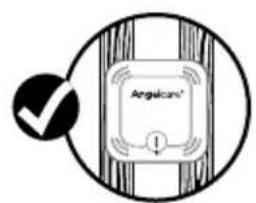 ANGELCARE AC527 - 2- SETTING UP THE SENSOR PAD - 4