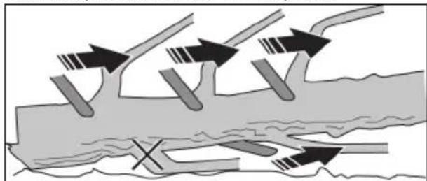 JONSERED CS16i - Ébranchage - 1