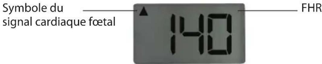 Luvion Doppler Deluxe80 - APPARENCE ET CONFIGURATION - 3