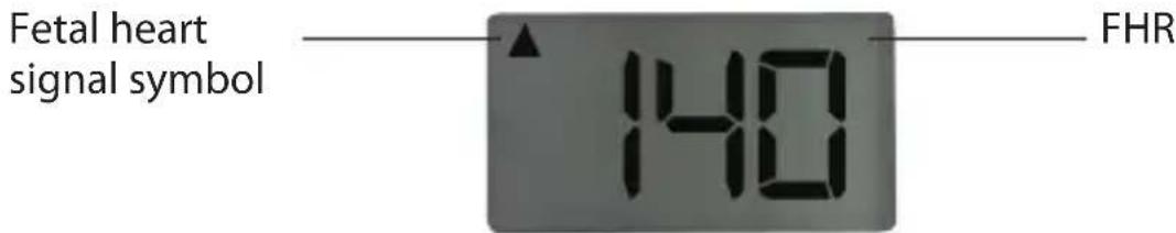 Fetal heart signal symbol 140 FHR