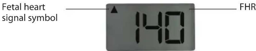 Fetal heart signal symbol 140 FHR