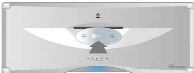 Linn Kivor Tunebox - Méthode 2 - 1
