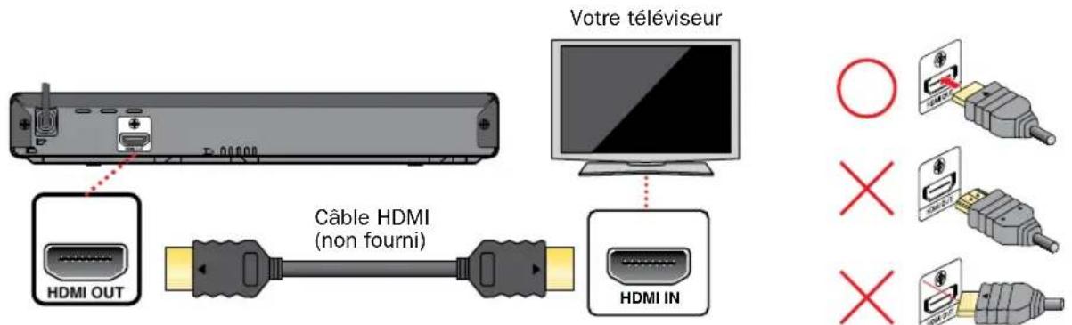 MAGNAVOX MBP1700 - Connexion au téléviseur - 1