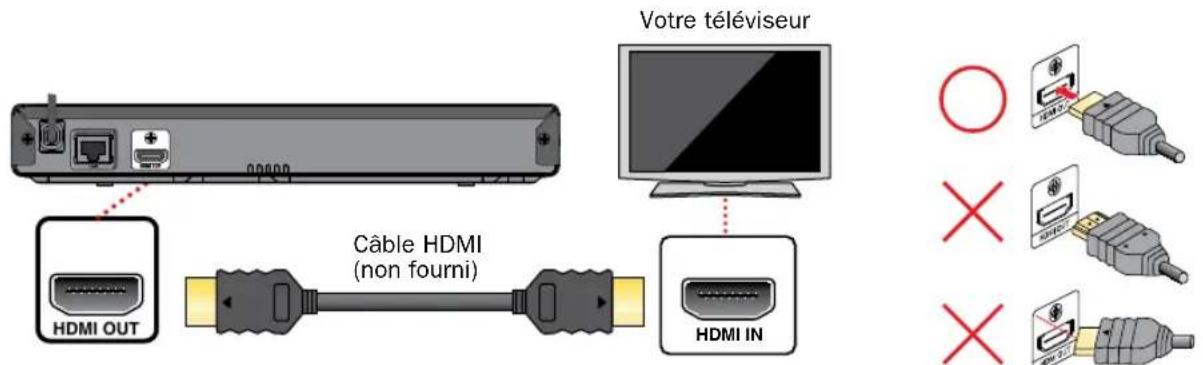 MAGNAVOX MBP5630 - Connexion au téléviseur - 1