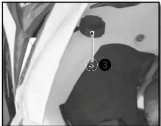 Medical X-ray image with numbered annotations and a catheter symbol pointing to a specific area