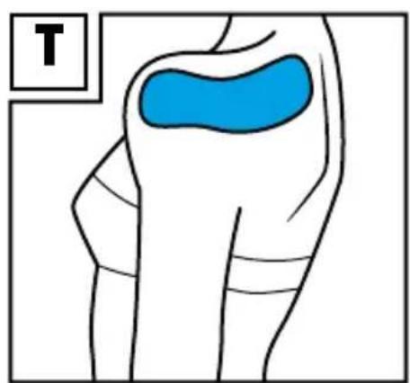 Sensiplast IAN 317349 - 20