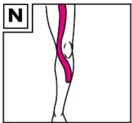 Sensiplast IAN 317349 - 14