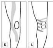 Sensiplast IAN 330530 - KINESIOLOGIE-TAPES KINESIOLOGY TAPE BANDES DE KINÉSIOLOGIE - 9