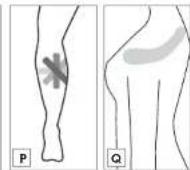 Sensiplast IAN 330530 - KINESIOLOGIE-TAPES KINESIOLOGY TAPE BANDES DE KINÉSIOLOGIE - 12