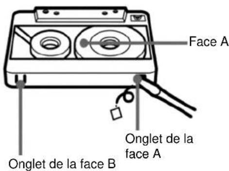 Soundmaster SRR70 - Enregistrement sur cassette - 1