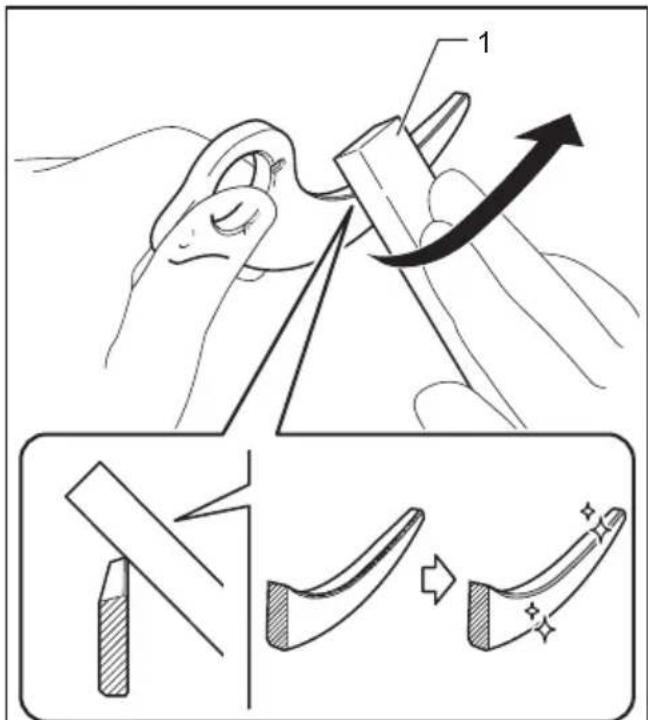 Medical illustration showing a surgical procedure for needle manipulation, with labeled steps and magnified views.