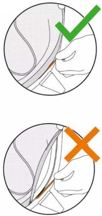 Medical illustration showing two steps of surgical procedure: checkmark and cross, with labeled anatomical diagrams.