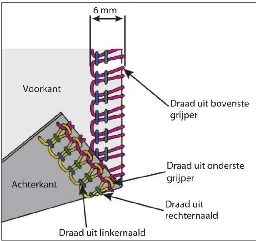 MEDION LIFE SO09 (MD 19169) - De draadspanning instellen - 1