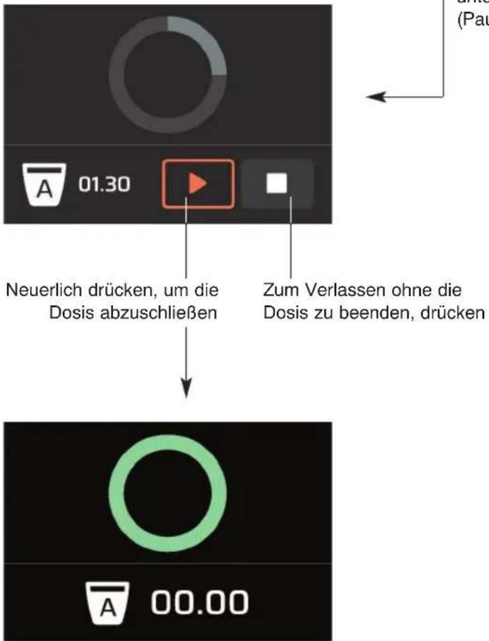 Ceado REV Titan - Automatischer Betrieb mit Starttaste (sofern vorhanden): "Click start"-Modalität (Abb. 7) - 3