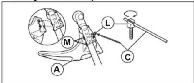 Diagram illustrating a medical or surgical procedure with labeled parts A, M, L, and C, including an inset image of a device with measurement indicators.
